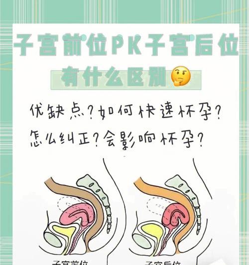 如何提高以子宫后位的受孕率（探索有效方法帮助提高受孕几率）