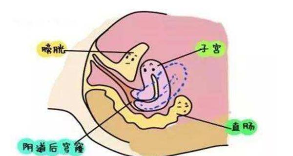 如何提高以子宫后位的受孕率（探索有效方法帮助提高受孕几率）