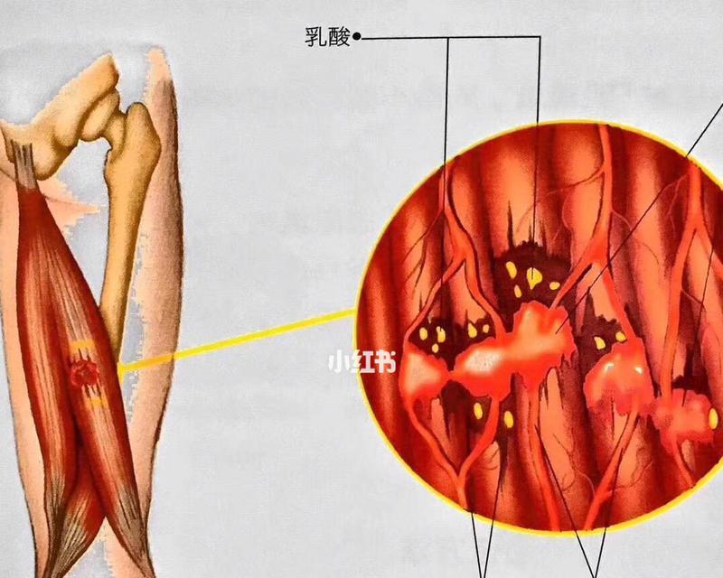 肌肉酸痛的原因和消除方法（探索肌肉酸痛的来源以及缓解疼痛的有效方法）